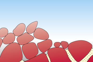 Formation d'un chaos granitique - étape 6